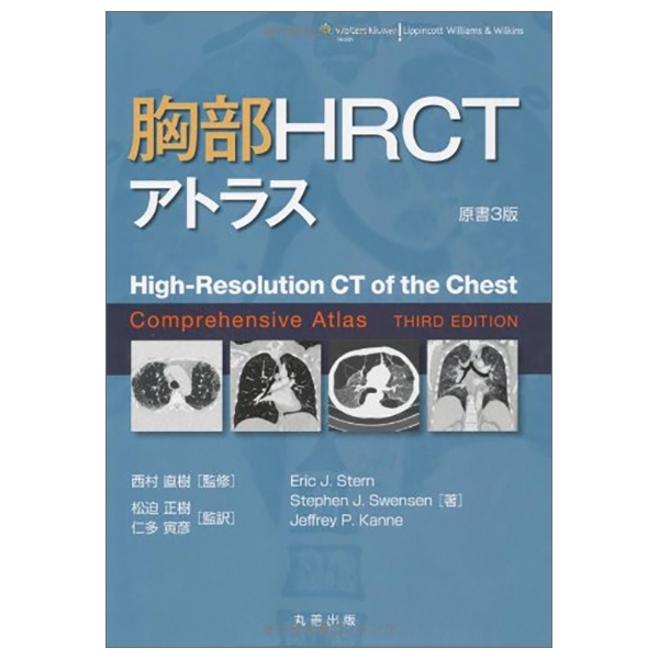 胸部 hrct アトラス - high-resolution ct of the chest comprehensive atlas